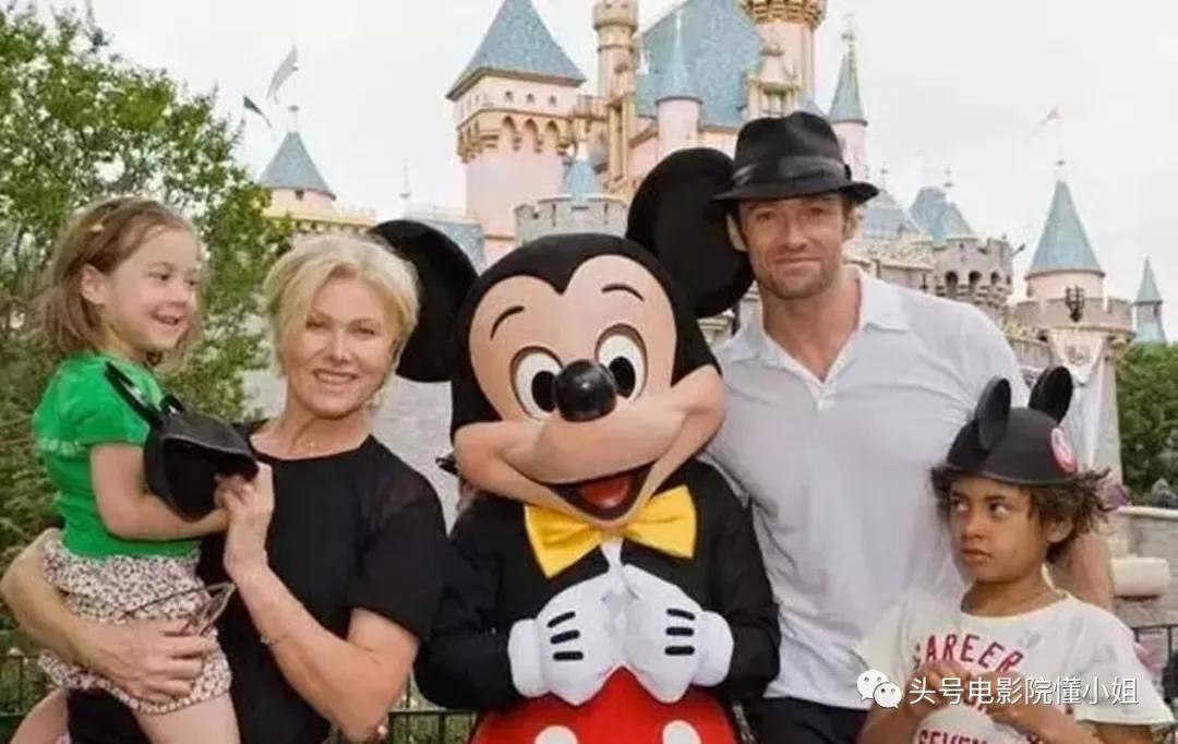 金刚狼爆皮肤癌危机！53岁休杰克曼提醒抹防晒霜，4年前曾动手术