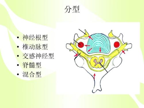 年纪轻轻得了颈椎病,颈椎病怎样才能更好地治愈