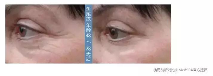 有了前法国第一夫人的百元“黑科技”眼霜,我把3000块眼霜扔了!