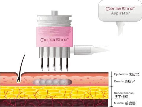 盘点护肤界的那些智商税,护肤界十大智商税