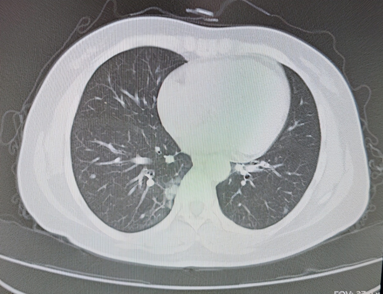 肿瘤哥被人嘲笑,肿瘤哥为什么会被全网嘲笑