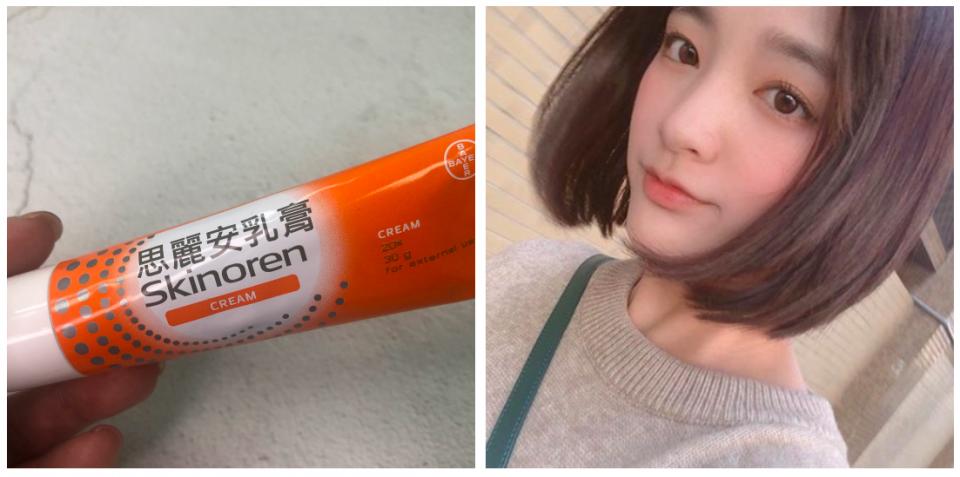 明星推荐止痛药膏,女明星用的药膏