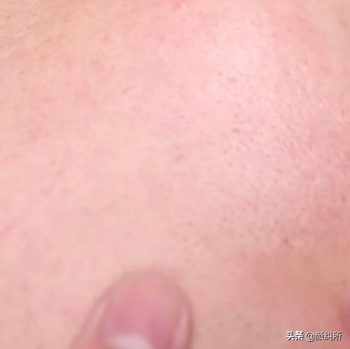 御泥坊九法净颜泥浆面膜使用方法,御泥坊氨基酸泥浆面膜会不会过敏