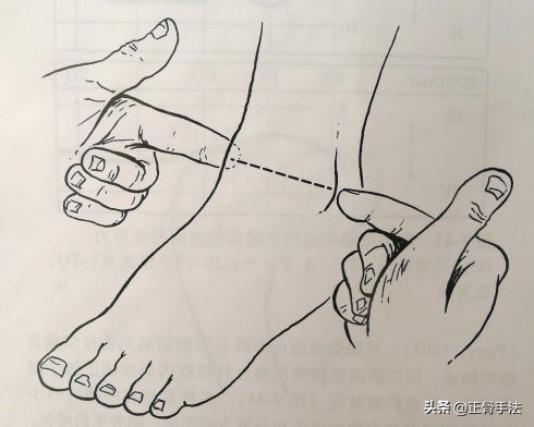 踝关节正骨复位手法,踝关节扭伤中医正骨手法