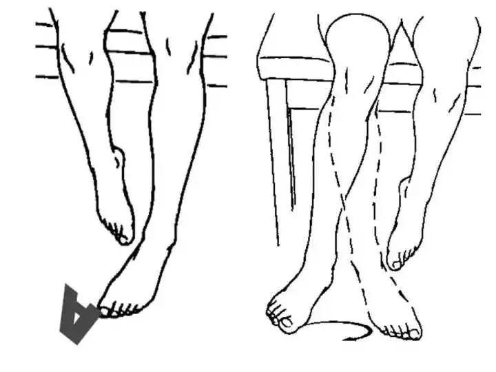 WildFieldHealth|如何解决习惯性崴脚？
