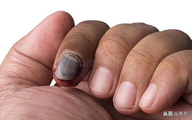 做美甲怎么防止手变黑小妙招,做的美甲颜色变黑了怎么办