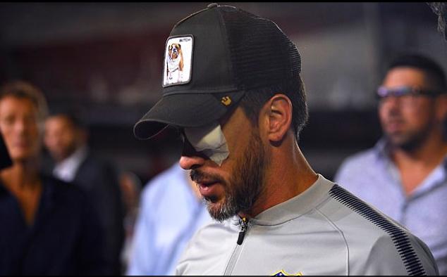 博卡大巴车事件,南美足球比赛大规模冲突球迷暴怒