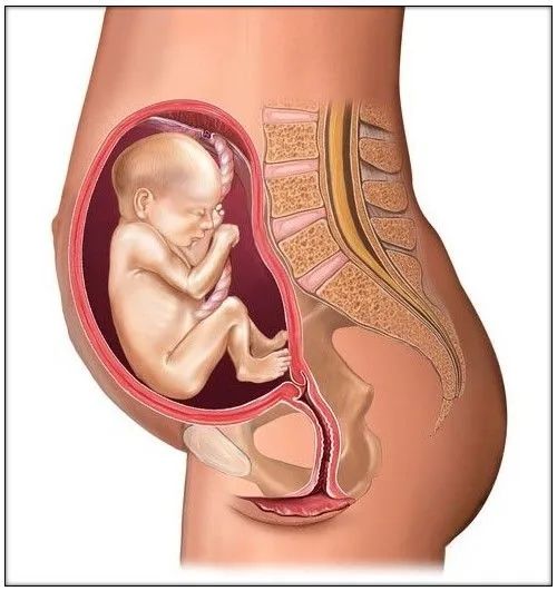 孕29周宝宝臀位需要纠正吗,29周臀位胎儿头在什么位置