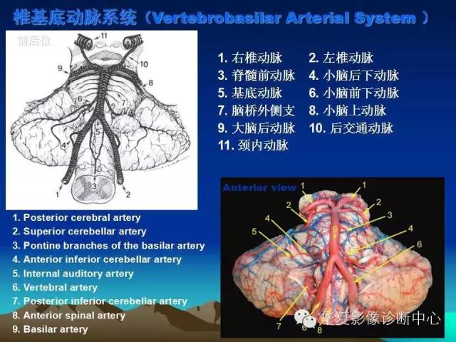 小脑血管解剖分段,脑血管影像解剖讲解