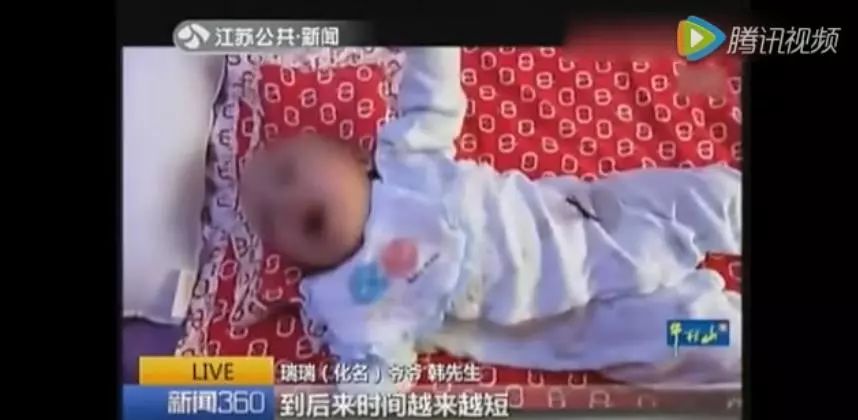 1岁宝宝偏瘫上肢康复训练,1岁孩子偏瘫康复视频