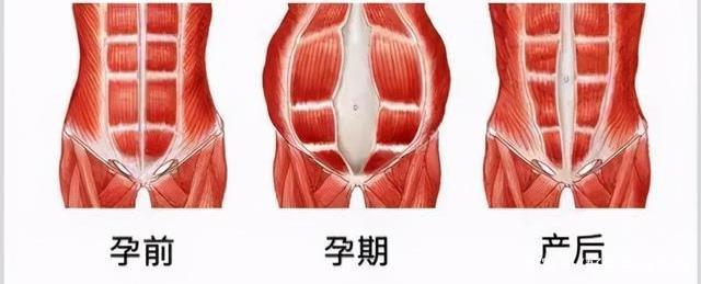 产后恢复包含哪些项目,产后恢复都包含哪些项目