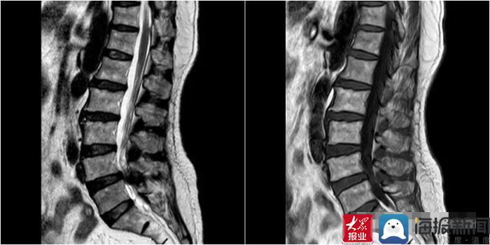 鑴婃煴寰垱鎵嬫湳璁惧,鑴婃煴鎵嬫湳鍏堣繘璁惧