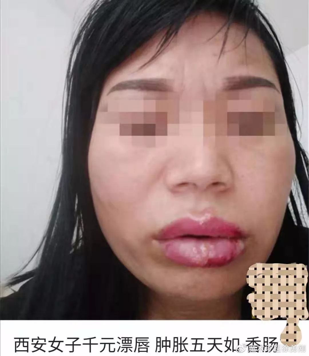 内行人为什么不建议漂唇,作为一名医生一直被人质疑