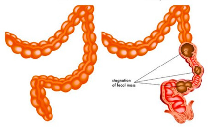 宝宝长期便秘十大危害,长期便秘十大危害