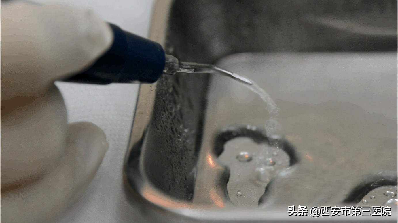 北大口腔洗牙收费标准,南京口腔医院洗牙流程