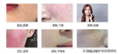 冬季怎样用精华油保湿皮肤,秋冬季节用精华油的好处