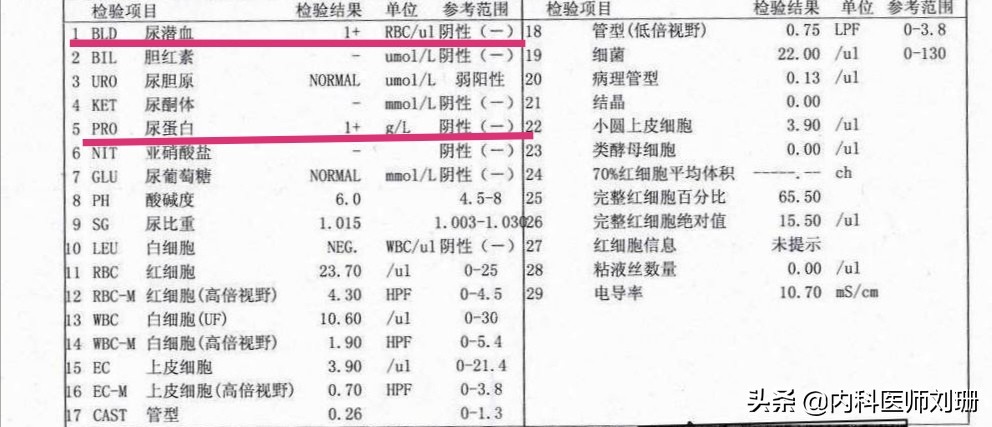 成人过敏性紫癜查过敏原均不过敏,过敏性紫癜不出现肾损害