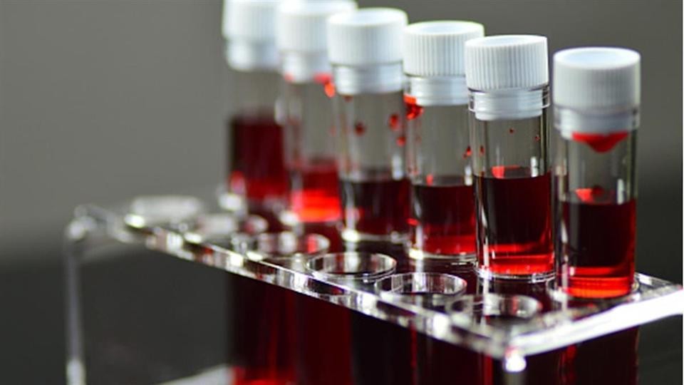 有没有比a3亚型血更珍贵的血型,稀有血型基因库