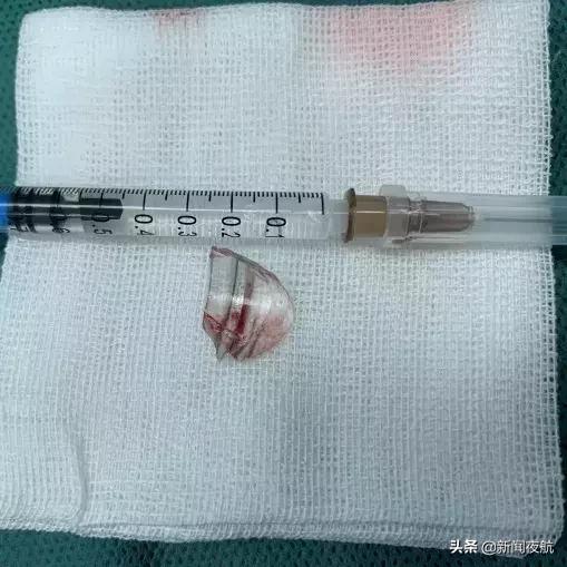 小孩误吞了玻璃碎渣有啥反应,如何判断小孩有没有误吞玻璃