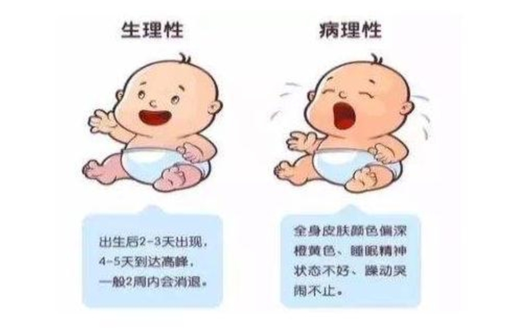 新生儿黄疸高在家怎样护理,新生儿黄疸偏高怎么办快速降下来