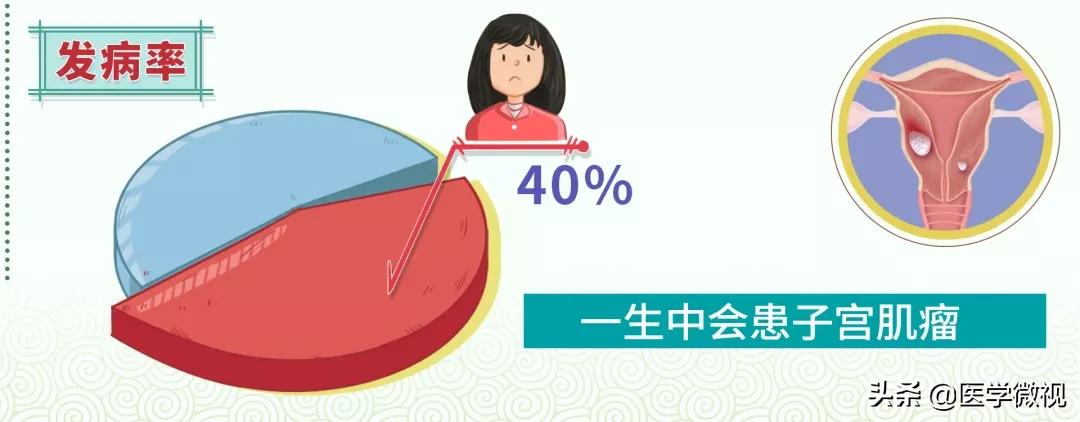 女性多发癌症,女人患上全球仅有300例的罕见肿瘤