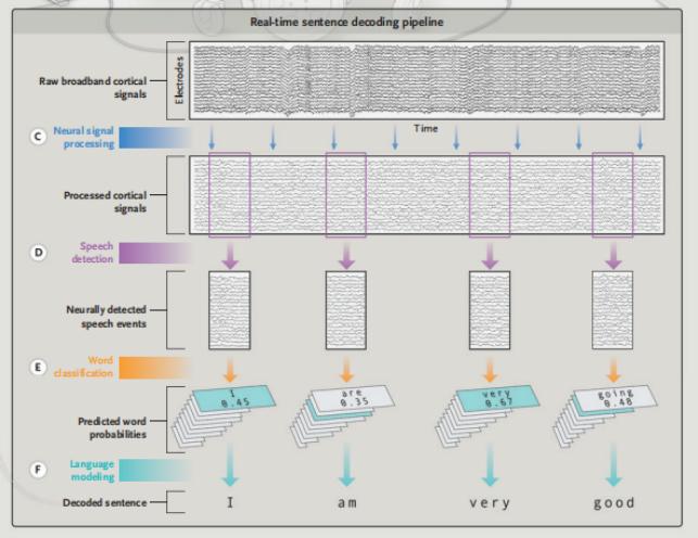 NEJM：全球首例AI+脑机接*技口**术让“失语”瘫痪患者实现沟通自由