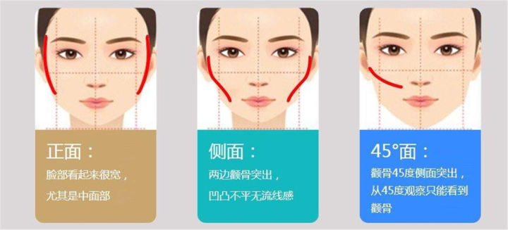 改善颧骨的10个方法,颧骨美学
