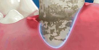 真正能把牙齿刷白的牙膏测评,进口去牙渍牙垢牙黄的牙膏第一名