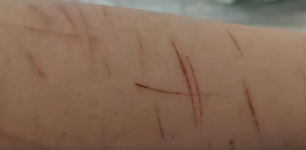 男孩校园霸凌被扒,北京16岁男孩被霸凌事件