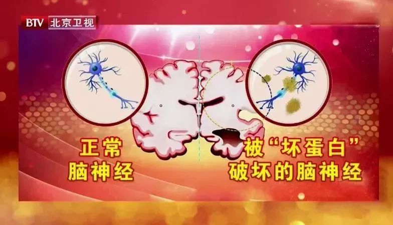 老年痴呆的十大危险信号你有吗,老年痴呆居然有20年的潜伏期