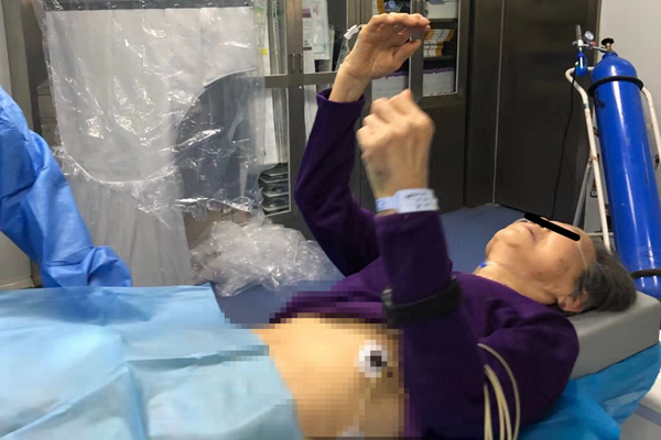 脑卒中6小时最佳治疗,延迟性脑梗死