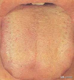 最实用的舌诊图六大舌象,舌诊深入学习书