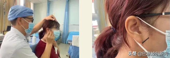 摆脱鼻炎困扰,过敏性鼻炎针刺哪些穴位有效