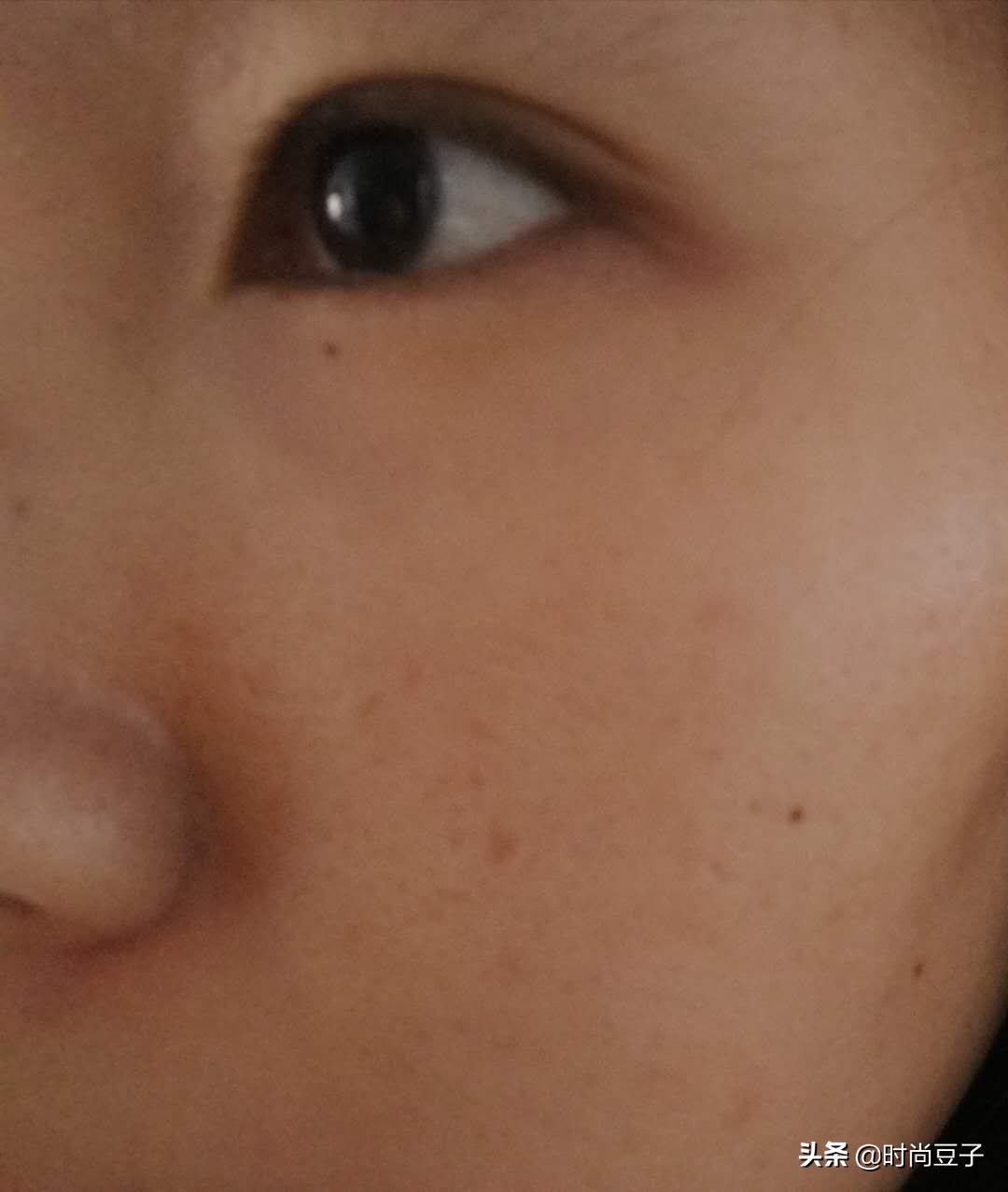 油痘肌推荐保湿定妆喷雾,油痘肌修复喷雾推荐测评