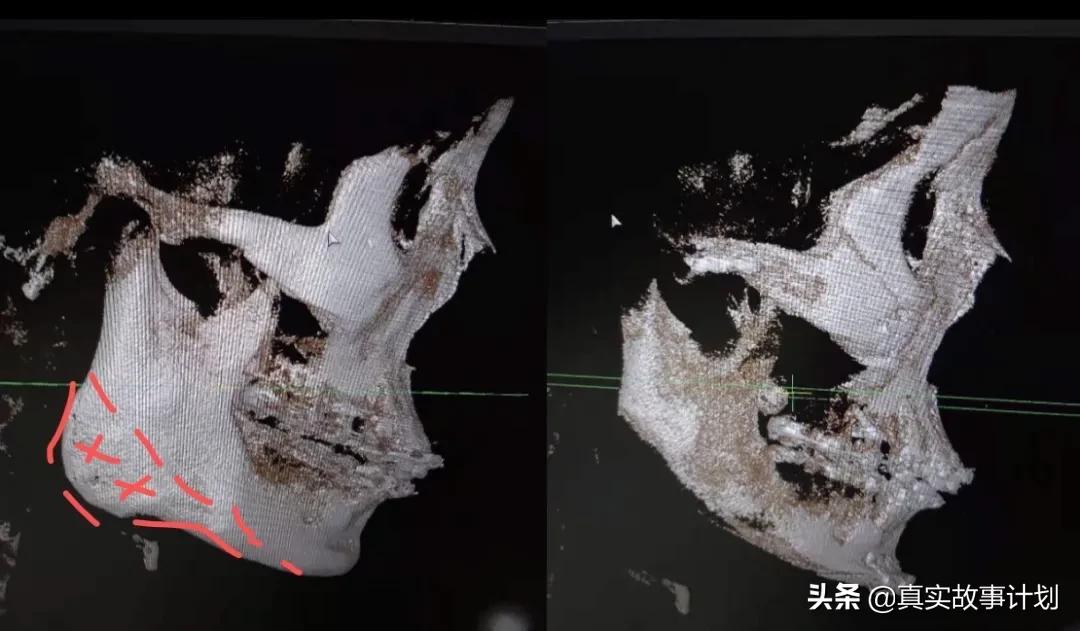 中国男整容成女的,中国男生整容变女神