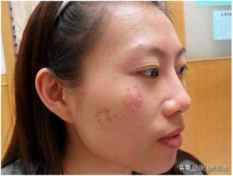 长斑最怕的3种食物,越吃越长斑的食物