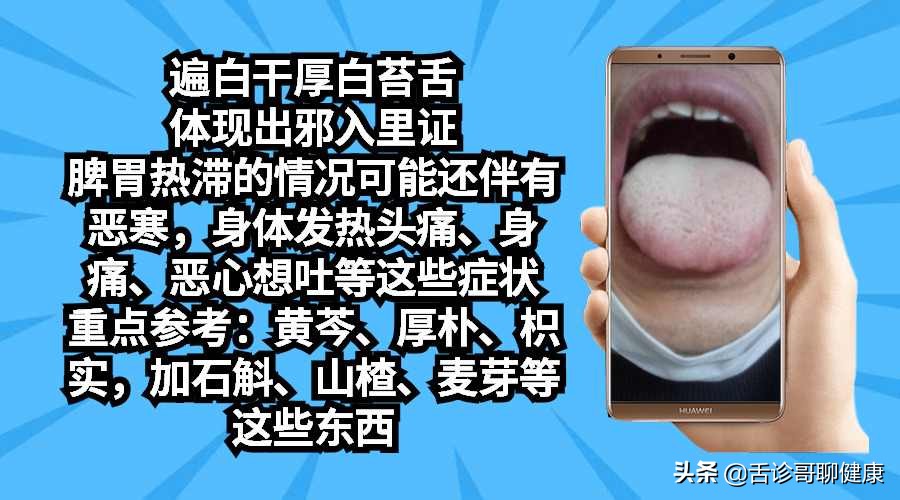 罗大伦舌诊图解肝郁气滞的舌象,抖音舌诊看体质