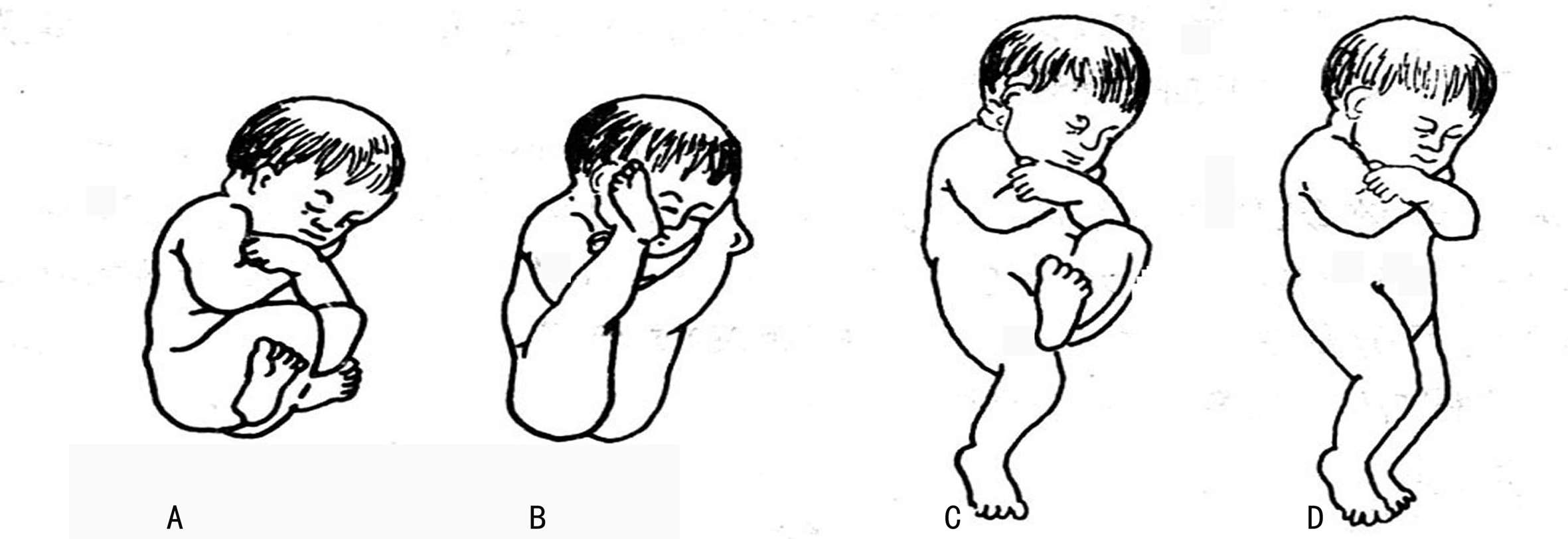 双胎什么时候做胎儿系统超声检查,双胎彩色超声检查