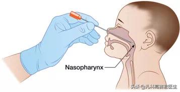 小孩肺炎支原体感染总反复怎么办,小孩肺炎支原体感染会复发吗