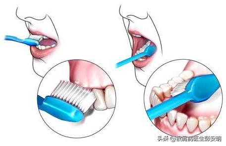 45岁男摘除扁桃体有什么危害,41岁扁桃体切除后后遗症