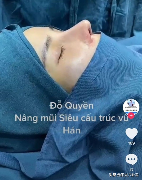 丑男整容变帅哥前后对比,丑男整容变帅哥对比照