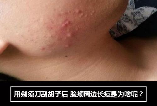 男生刮胡子的6个常识你刮对了吗,男生刮胡子是最高礼仪嘛