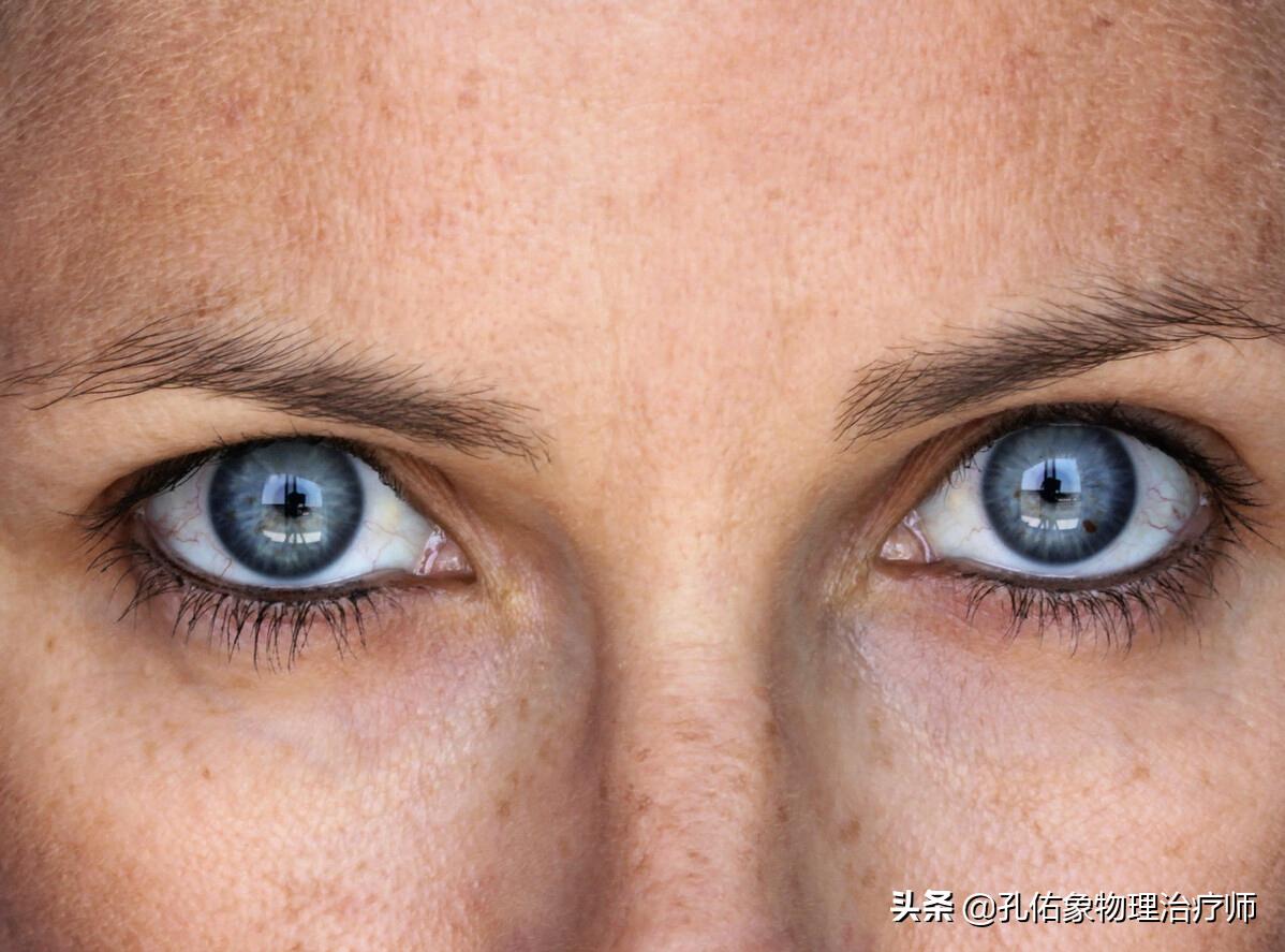 多年的老年斑消除最好的方法,为什么会长老年斑如何可以去除