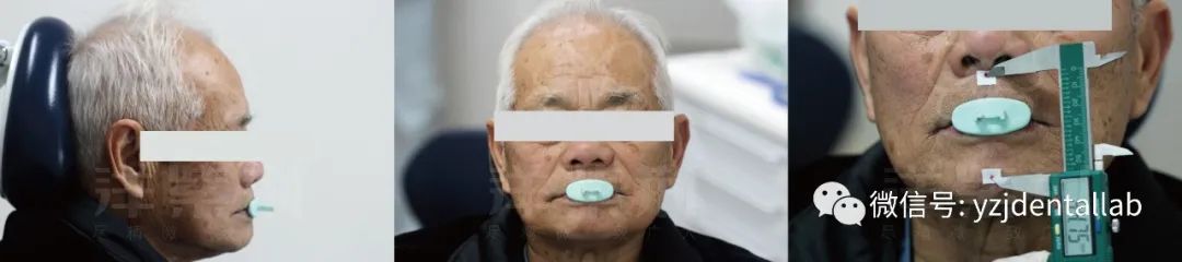 病例教学视频,病例分析操作技能