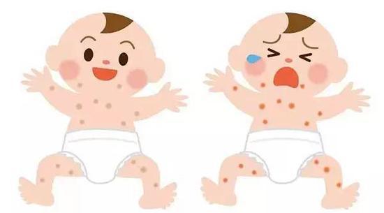 春季婴儿湿疹高发日常护理很关键,哺乳期孩子湿疹家长需要排湿气吗