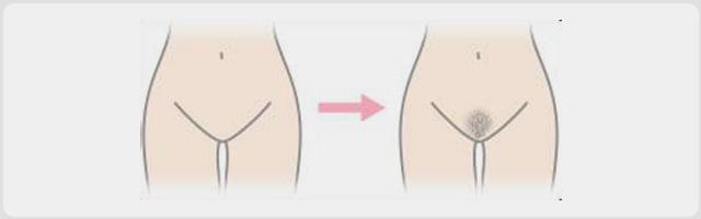 性健康有问必答26：隐私部位长毛怪怪的，可以剃掉吗？