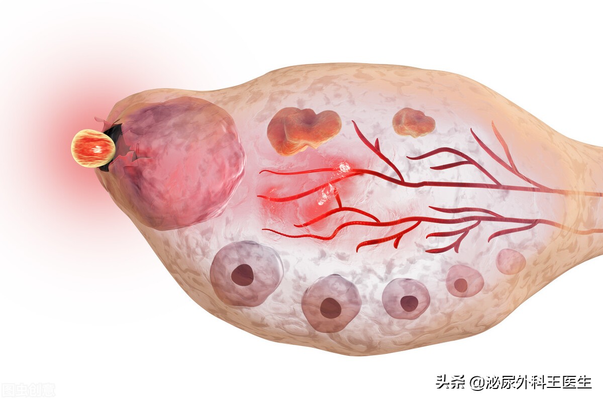 没遇上卵子的精子，最终会去哪里？