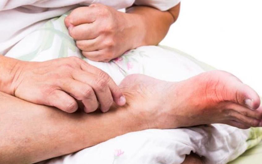 喝完酒后急性痛风发作怎么办,痛风喝完酒后可以吃止痛药吗