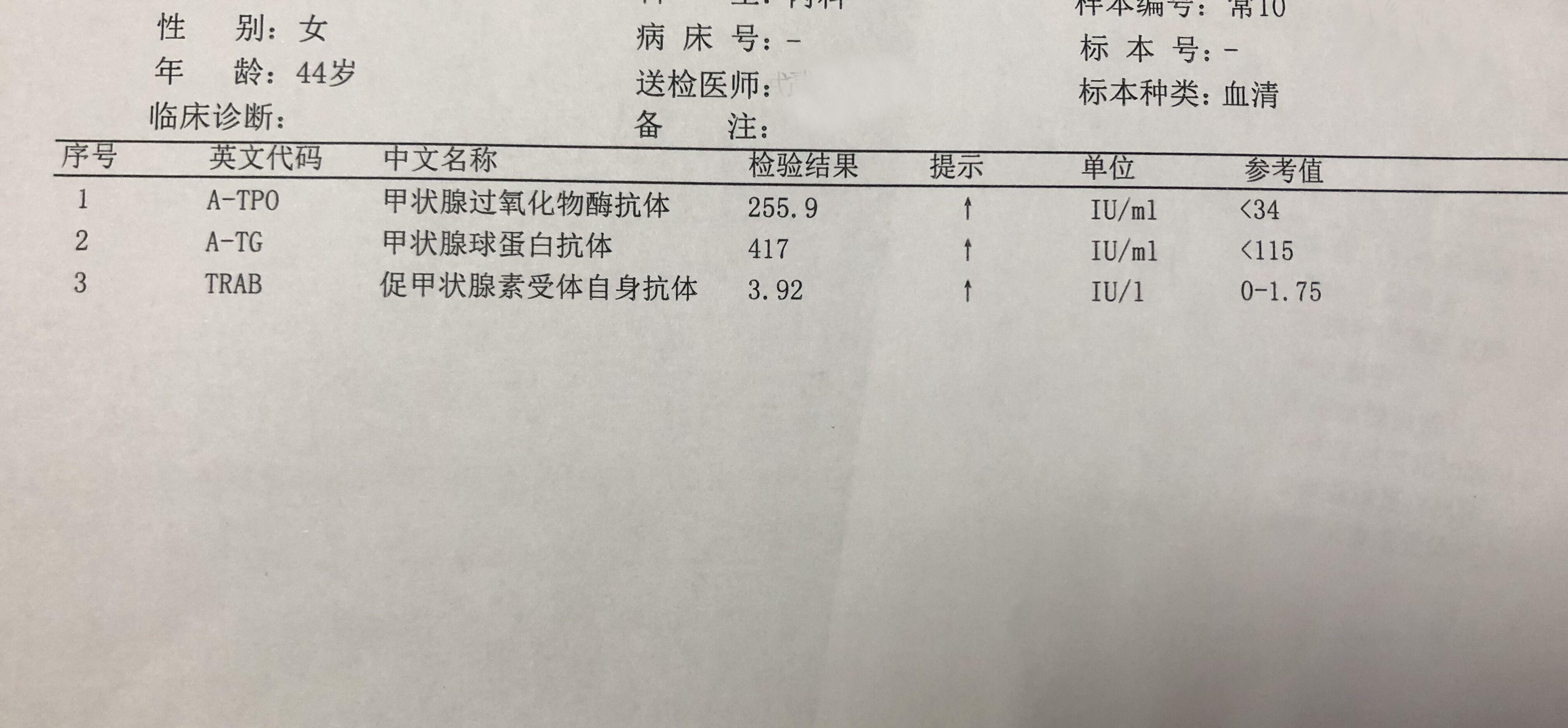 桥本休止期脱发能恢复吗,桥本患者2阳后脱发