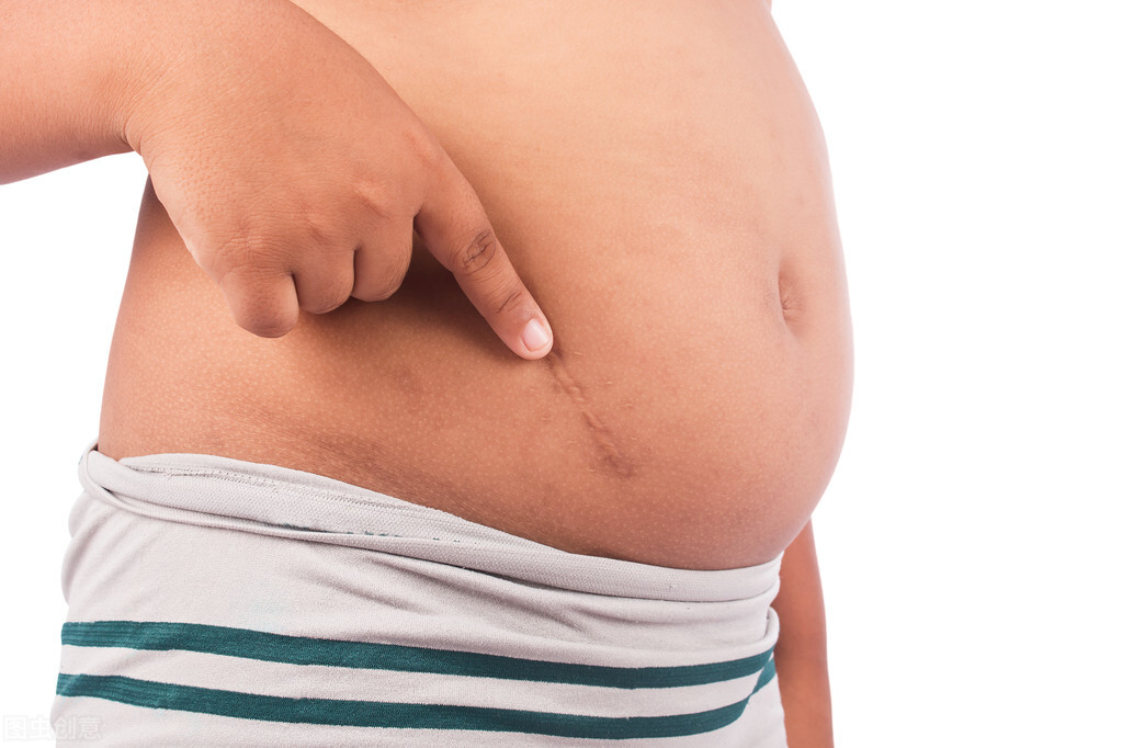 手术缝针疤痕能不能完全祛除,小孩额头缝针疤痕祛除最佳时间